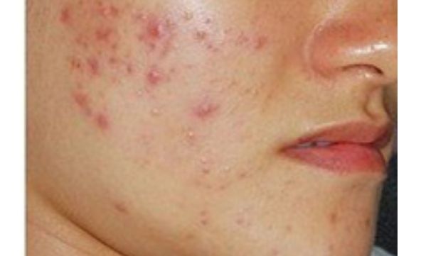 想了解寧波慈溪圣愛醫(yī)院醫(yī)療美容整形科價格表？醫(yī)生口碑如何？