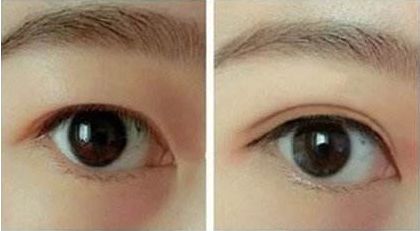 合肥哪家整形醫(yī)院好口碑好服務(wù)好值得推薦？