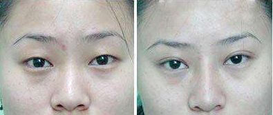 武警廣西總隊醫(yī)院怎么樣？武警廣西總隊醫(yī)院簡介|醫(yī)生團隊|口碑評價！