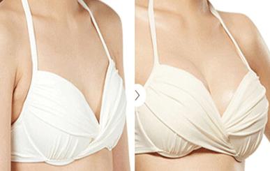 2023重慶冷凍法去黃褐斑強(qiáng)榜前十強(qiáng)的醫(yī)生(邵雅娟、吳細(xì)輕、劉玉婷評價(jià)一致贊美)