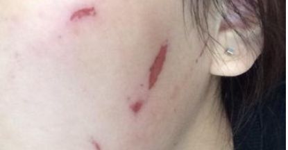 石家莊雅芳亞醫(yī)療美容醫(yī)院的醫(yī)院簡介及醫(yī)生資料是什么？