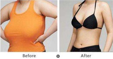 深圳雙眼皮修復哪家好？機構(gòu)排名及評價調(diào)查報告