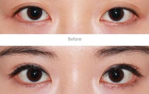 沈陽市整形外科醫(yī)院哪家效果好，口碑最佳？