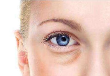 張娟醫(yī)生做雙眼皮術效果如何？