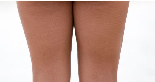 成都哪家醫(yī)院做眼袋好，治療眼袋效果明顯的醫(yī)院有哪些