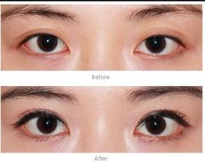 鄭州整容醫(yī)院哪家好？教你如何選擇適合自己的整容醫(yī)院