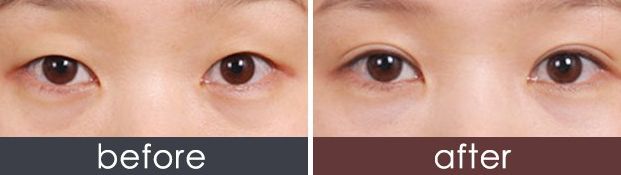 西安哪家美容醫(yī)院口碑好，專業(yè)評測推薦？