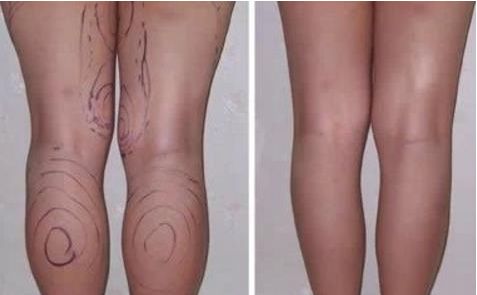 揭秘景德鎮(zhèn)扎堆的微整醫(yī)院哪家好，如何選到最適合你的一家？