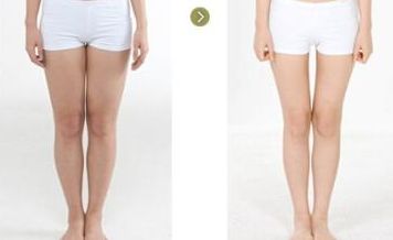 貴州整容醫(yī)院哪家好？權(quán)威專家為您推薦