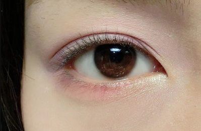 王世虎拉皮和脂肪填充的效果如何？有哪些多樣化的項目值得選擇？技術(shù)是否可靠可證？