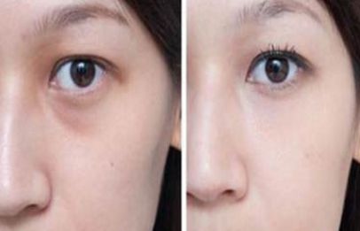 上海整形私密醫(yī)院排名及口碑，哪家好？