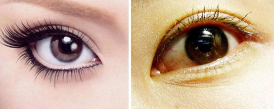 安徽省哪家醫(yī)院割雙眼皮效果最好，技術(shù)最先進(jìn)，口碑最好？