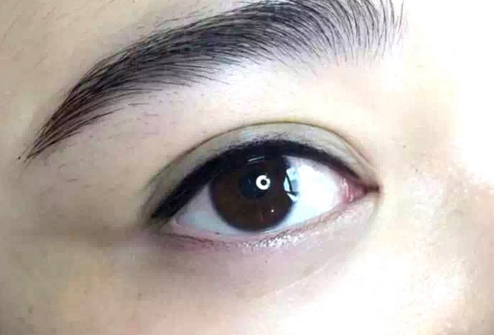 專業(yè)評測：暴志國VS郭金冉，誰的雙眼皮更迷人？鄭州整形名醫(yī)實(shí)力PK，絕無遺憾！術(shù)前必看，挑選整形專家前不