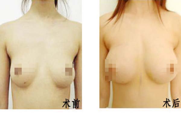 北京景區(qū)楊斌突嘴手術(shù)矯正效果如何？從個人實力和大眾評價來分析