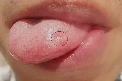 2023深圳細(xì)胞填充眼袋排名榜top10強(qiáng)的專(zhuān)家(鄭旭東、雷玉琳、鄒銳靠譜不踩雷~)