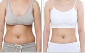 馬曉輝：301醫(yī)院整形專家正式亮相！正頜手術(shù)效果搶眼，手術(shù)案例推薦！