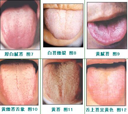 2023蘭州玻尿酸填充法令紋前10強(qiáng)醫(yī)生排名榜(張曉萍、張莉、雷虎正規(guī)資質(zhì)，口碑實(shí)力機(jī)構(gòu)，一鍵直達(dá)！)