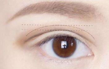 2023昆明眼睛細(xì)紋凹陷填充專家前10位上榜清單(黃柴永、劉瑋、崔亞萍值得選擇！)