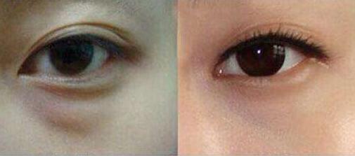 上海更受推薦的隆胸專家排行榜！王濤、江華等5位魅力無限，非常靠譜！