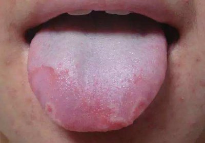 2023宜賓自體脂肪填充眼窩正規(guī)專家推薦前10位(尤軍、詹清、王喬干貨帖收藏)