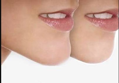 上海除疤痕哪家醫(yī)院好？選擇這家專業(yè)醫(yī)院，讓你告別疤痕煩惱！