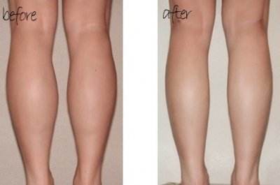 2023邯鄲韓式開眼角整形手術(shù)正規(guī)專家上榜前十名(顏紅亮、張紅霞、曲勝內(nèi)行直呼)