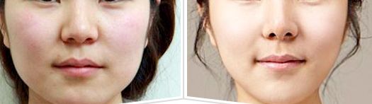 廣西哪家整形美容科醫(yī)院值得選擇？