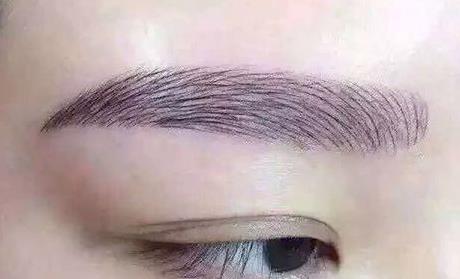 穆寶安拉皮術(shù)：北京抗衰行家評(píng)價(jià)及手術(shù)費(fèi)用、醫(yī)院選擇指南