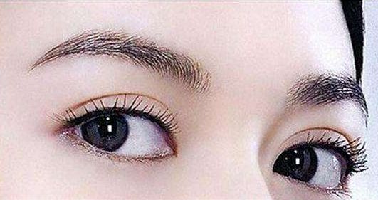 深圳哪家醫(yī)院的雙眼皮手術(shù)效果好？