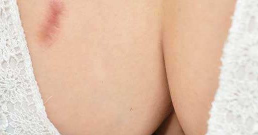 山東小陰唇手術哪家正規(guī)專業(yè)值得選擇？