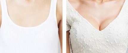 上海抽脂整形醫(yī)院排名2023：哪家好且性價(jià)比更高？