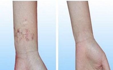 濟(jì)寧去雀斑醫(yī)院哪家好？揭秘濟(jì)寧市治療雀斑效果最好的醫(yī)院