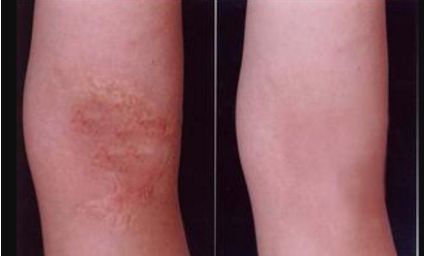 河北雙眼皮手術(shù)哪家好？挑選專業(yè)技術(shù)與良好口碑并存的醫(yī)療機構(gòu)！