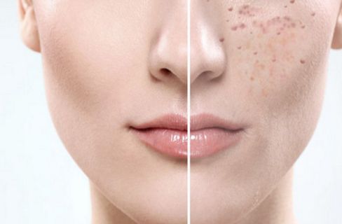 福建泉州海峽醫(yī)療美容醫(yī)院怎么樣？福建泉州海峽醫(yī)療美容醫(yī)院簡介|醫(yī)生團隊|口碑評價！