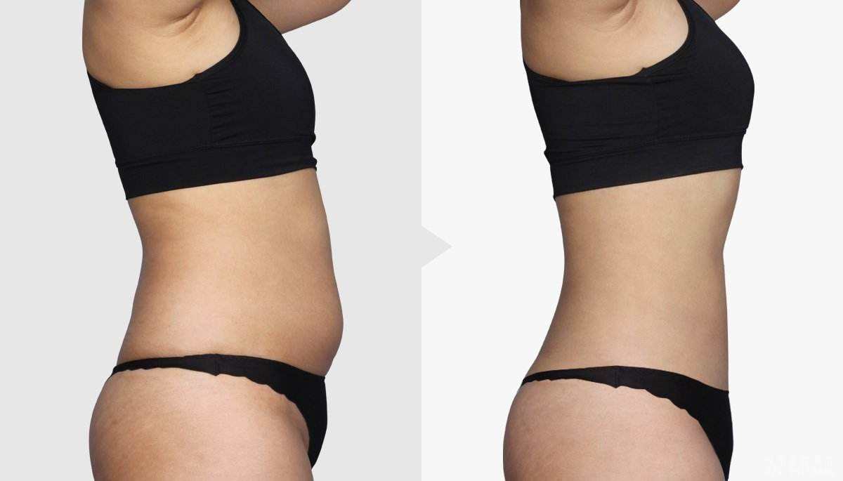 2023黃石玻尿酸原液正規(guī)醫(yī)生評分前幾(彭靜、楊天赤、步長龍等都是不錯的醫(yī)生！)