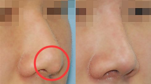 福州哪家醫(yī)院做疤痕好？比較全面的福州疤痕治療醫(yī)院推薦給您！