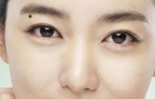 認(rèn)識眼部大咖，探索秦宏偉醫(yī)生的簡介及雙眼皮案例分享