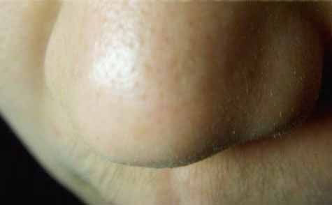 2023長(zhǎng)春假體墊鼻基專家上榜名單前十強(qiáng)(趙雯、唐愛(ài)東、黃慶吉實(shí)力正規(guī)靠譜)