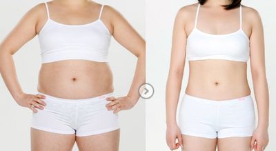 蘇州祛斑好醫(yī)院哪家好？專家推薦：蘇州效果好的祛斑醫(yī)院排行榜