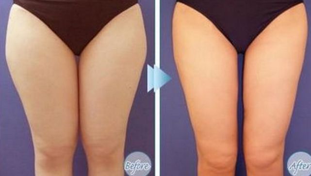 大連專業(yè)祛斑哪家醫(yī)院好？祛斑效果最好的醫(yī)院有哪些？