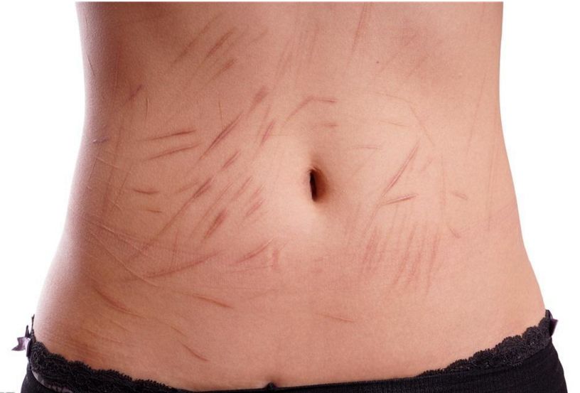 南京抽脂手術(shù)那家醫(yī)院技術(shù)靠譜？哪家醫(yī)院的抽脂效果好？