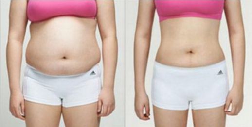 南昌哪家醫(yī)院的吸脂效果好？