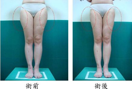 昆明哪家治痘痘好的醫(yī)院，痘痘問(wèn)題如何有效解決？