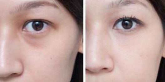 武漢看胎記醫(yī)院哪家好？綜合醫(yī)療機構(gòu)排行榜詳細解讀