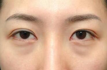 杭州面部提升醫(yī)生和專(zhuān)業(yè)醫(yī)院介紹，了解小拉皮技術(shù)好的醫(yī)生