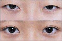 2023成都射頻祛靜態(tài)紋權(quán)威醫(yī)生排行前10名(汪國義、藍安惠、陳衛(wèi)華嚴選專家，實力過硬！)