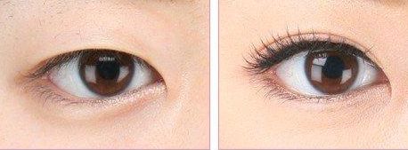 上海哪家醫(yī)院做處女膜修復(fù)好？