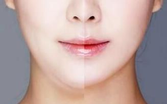 2023岳陽大腿吸脂修復(fù)正規(guī)醫(yī)生排行榜10強(qiáng)(歐陽燕萍、高景恒、楊淑云這幾個專家名氣都不錯！)