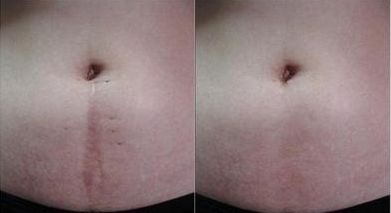 宜昌眼科醫(yī)院哪家好，專業(yè)眼科醫(yī)生助您解答