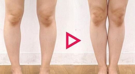 南昌二附院整形科腰腹吸脂是否可靠？醫(yī)生專業(yè)解讀幫您解答